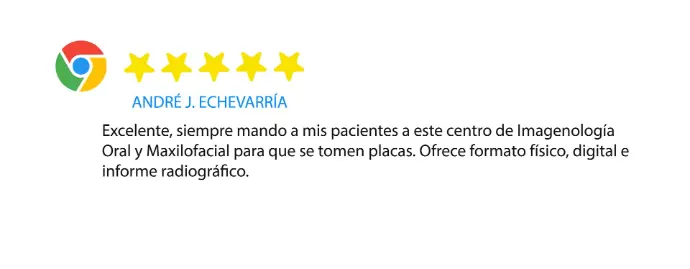 Review Edward Alarcon Silva